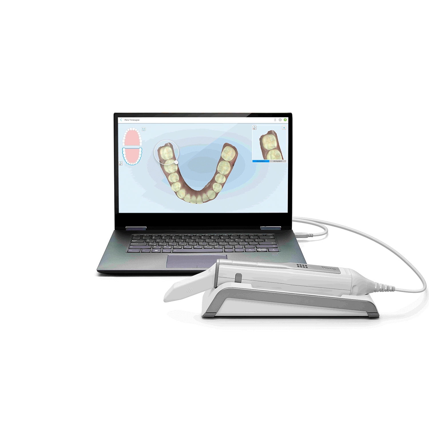 D0203 iTero Element Flex Ağız İçi Tarayıcı